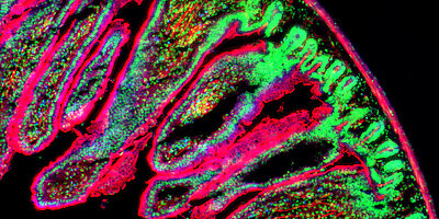 Digitale Pathologie – die Forschung im Fokus