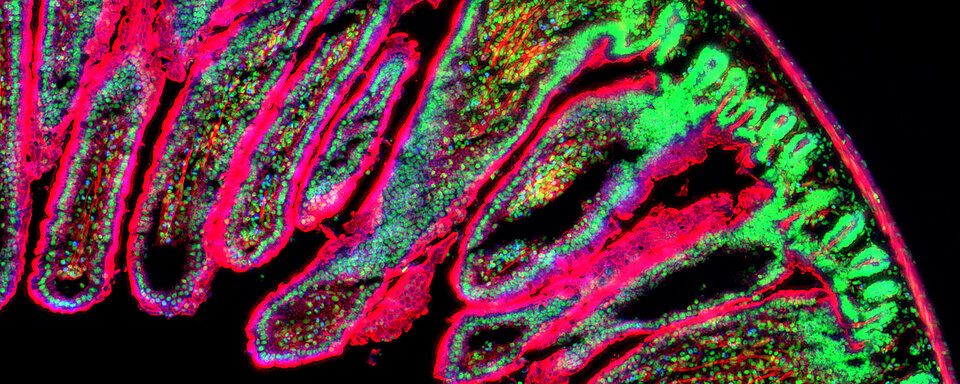 Digitale Pathologie – die Forschung im Fokus