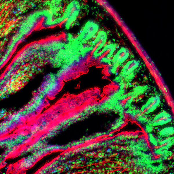 Digitale Pathologie – die Forschung im Fokus