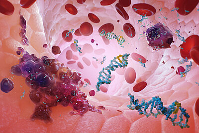Liquid Biopsy