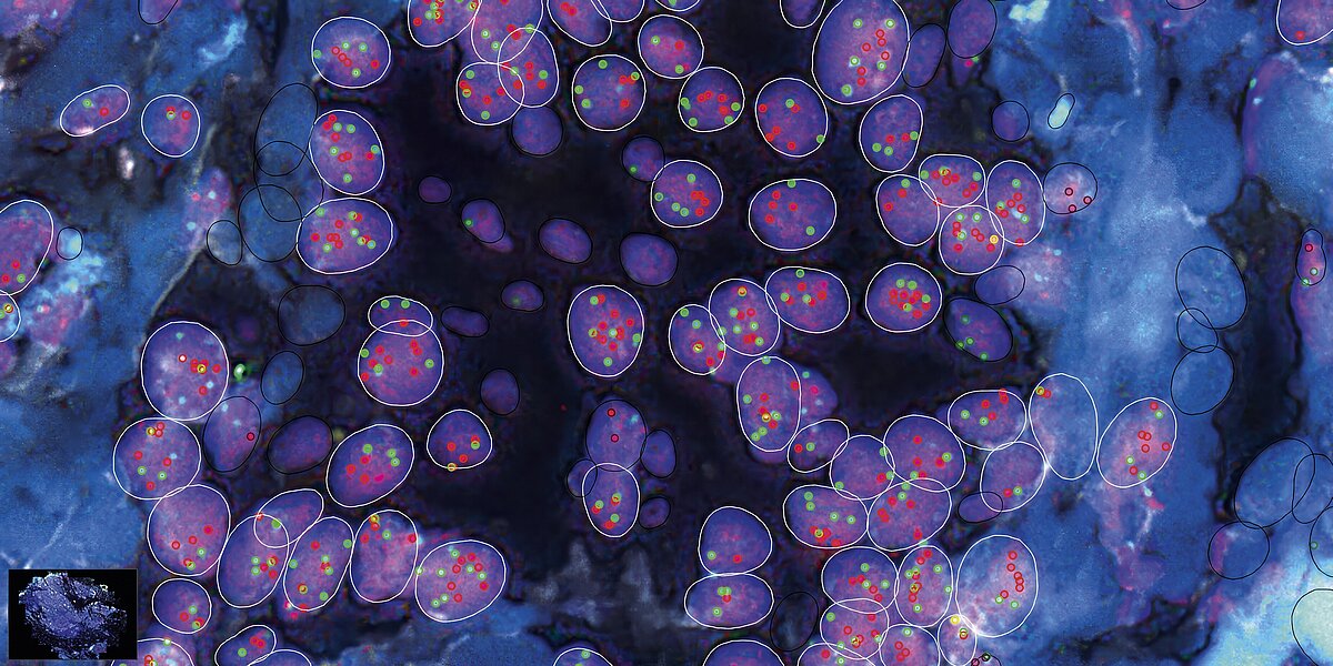 Mit der Software von Katana Labs wird das lästige Zählen von FISH-Signalen am Mikroskop überflüssig