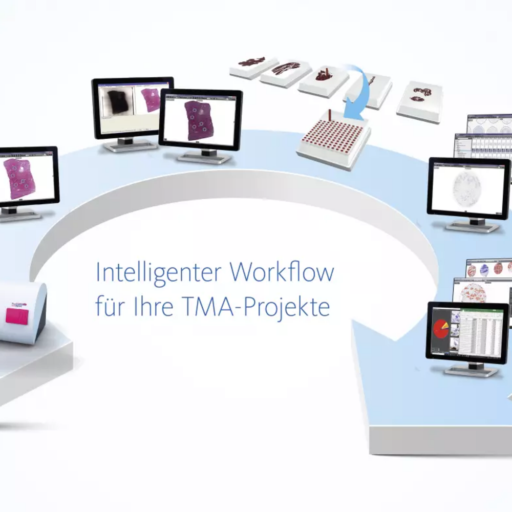 Analyse digitaler TMA-Slides mit dem 3DHistech QuantCenter