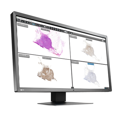 EIZO MX317W