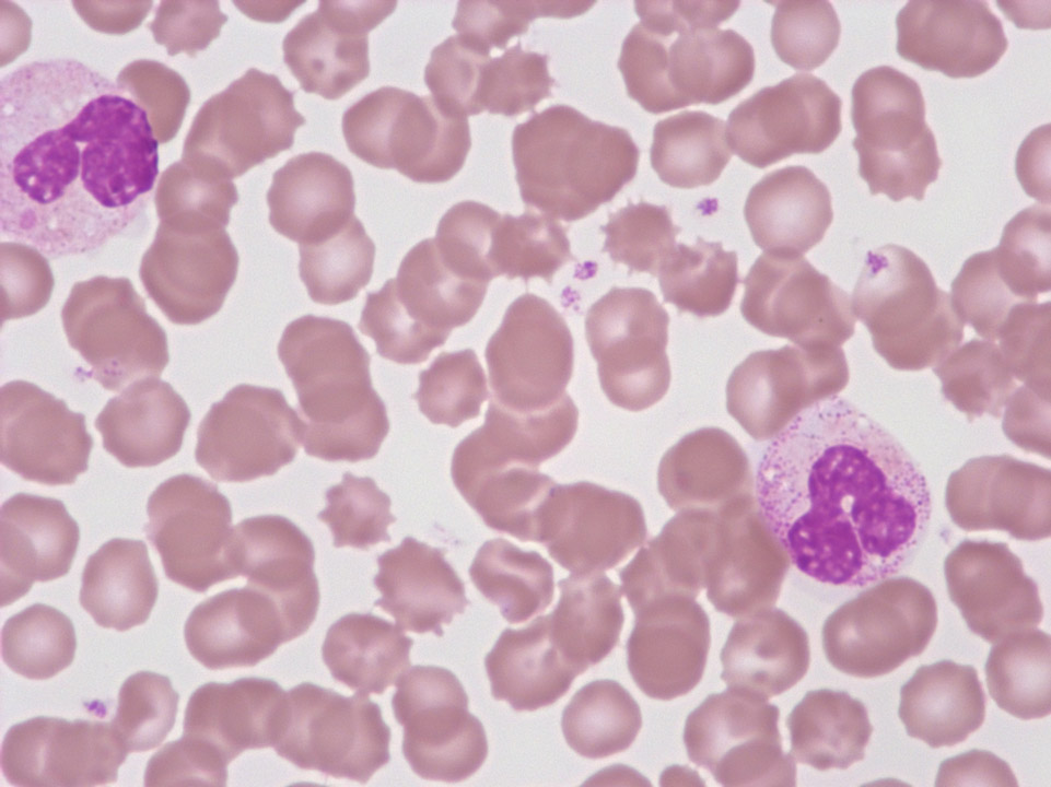 Stabkernige neutrophile Granulozyten Stabkernige neutrophile Granulozyten