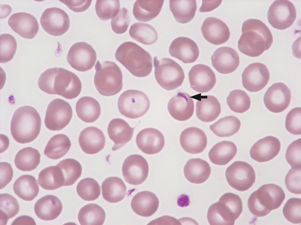 Überlagerung von Erythrozyten mit Thrombozyten Überlagerung von Erythrozyten mit Thrombozyten