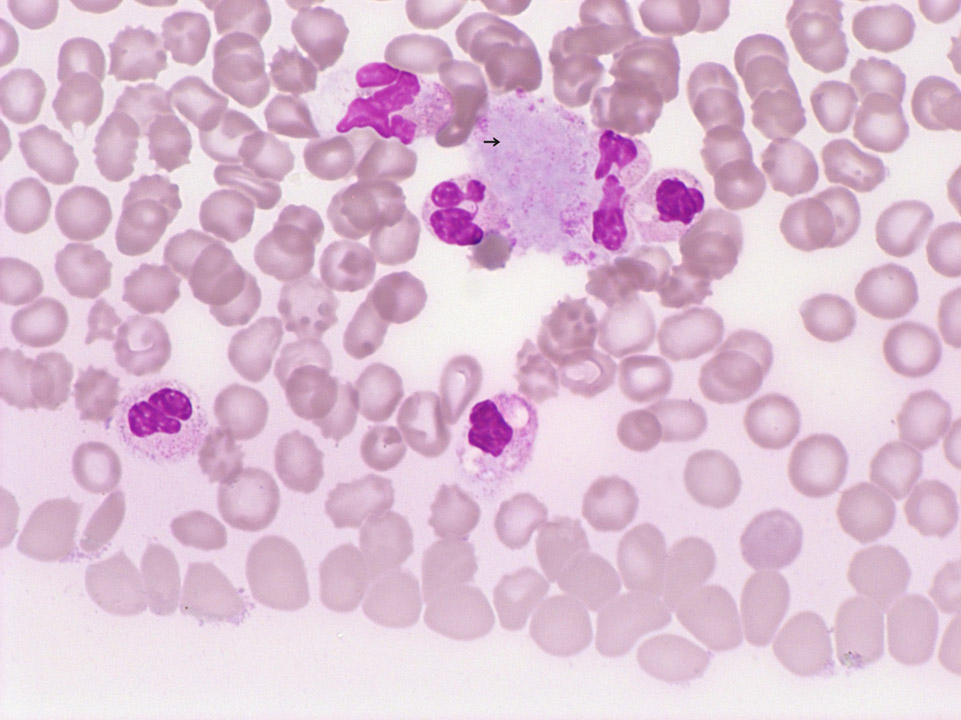 Thrombozytenaggregate Thrombozytenaggregate