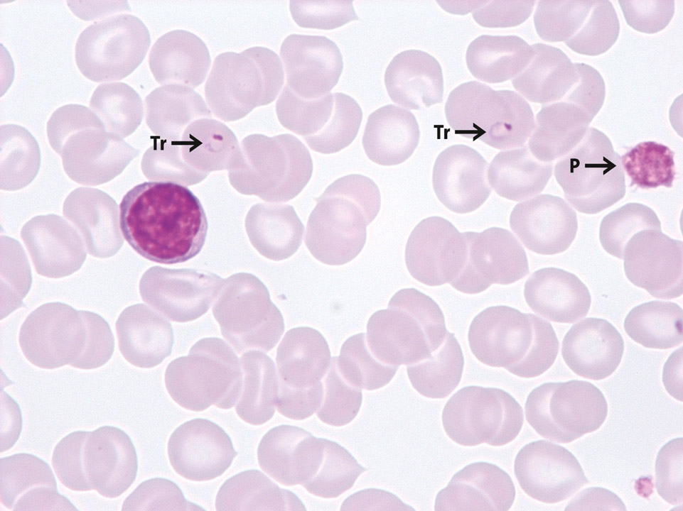 Trophozoiten, Malaria tropica Trophozoiten, Malaria tropica