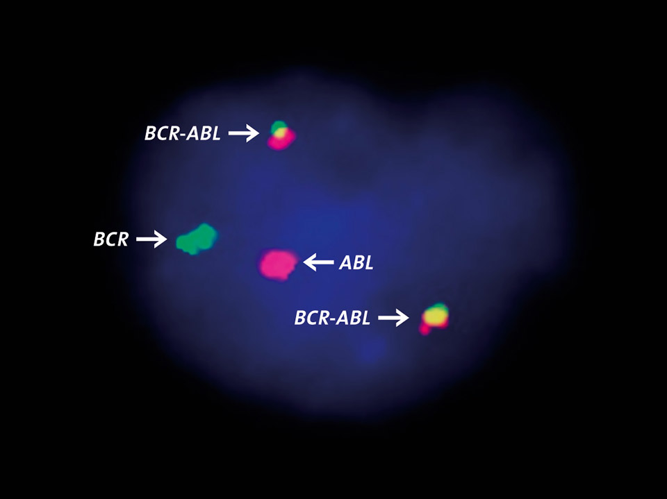 BCR-ABL-Fusionsgen, Nachweis mittels Fluoreszenz-in-situ-Hybridisierung