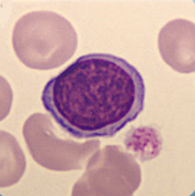 Lymphocyte Lymphocyte